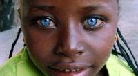 Dark Skin Light Eyes Ideas Beautiful People People Beautiful Eyes