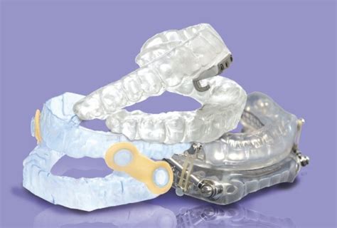 Dental Appliance For Sleep Apnea Information Dernasam