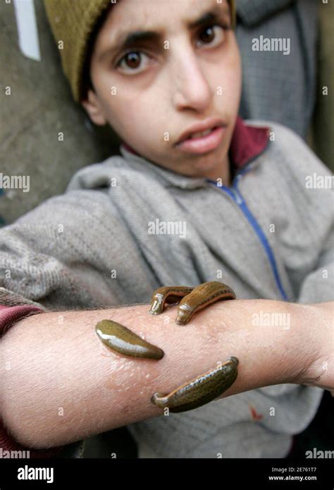 Indian Leech Hi Res Stock Photography And Images Alamy