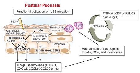 Highlighting Interleukin 36 Signalling In Plaque Psoriasis And Pustular