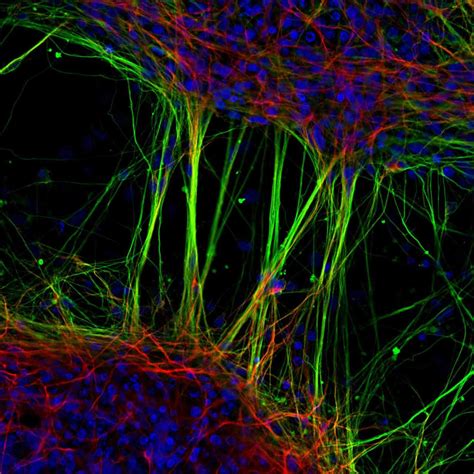 Éstas son las mejores fotografías del mundo microscópico 2022 Uno TV