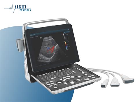 The Evolution Of Ultrasound Machines Advancements And Breakthroughs