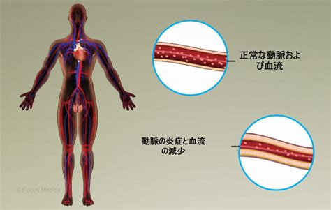 Health Condition Symptoms Causes Treatment And More