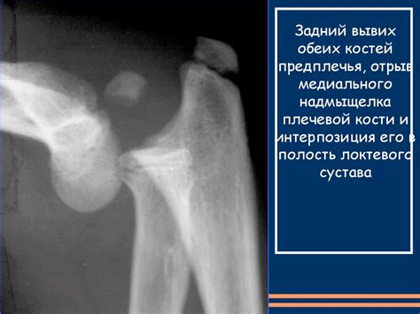 Особености травматологии детского возраста - презентация онлайн