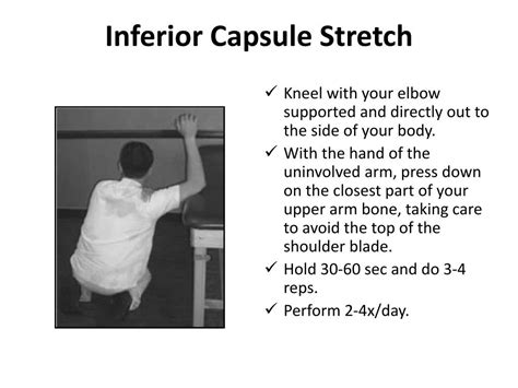 Ppt Anterior Capsule Stretch Powerpoint Presentation Free Download