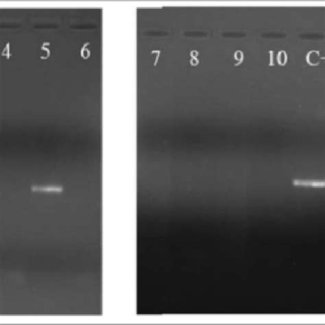 PPRV N Gene Specific RT PCR Amplification Lane M GeneRuler 100 Bp