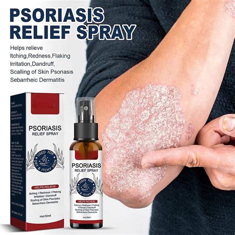 Ml Psoriasis Treatment Spray Hand Foot Scalp Eczema Tinea Anti Itch