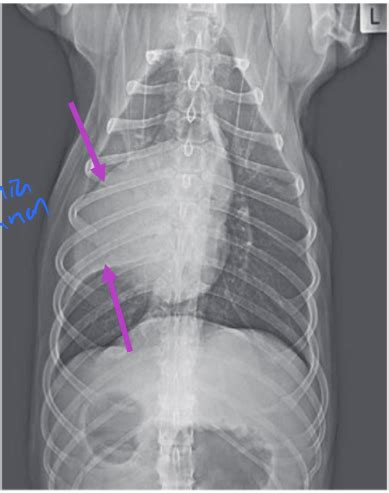 Exam Surgery Of The Upper Airway Flashcards Quizlet