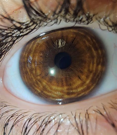is it normal for my eyes to look like this lol?? i've never seen such ...