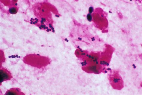 Mrsa Bacteria Gram Stain