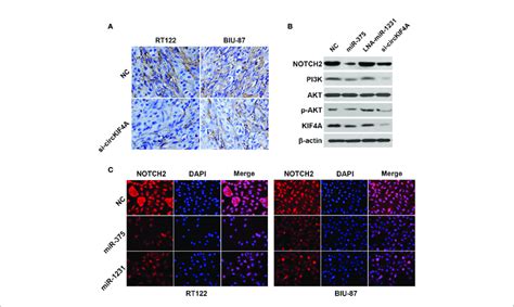 Circkif4a Promotes Bladder Cancer Progression Via The Download