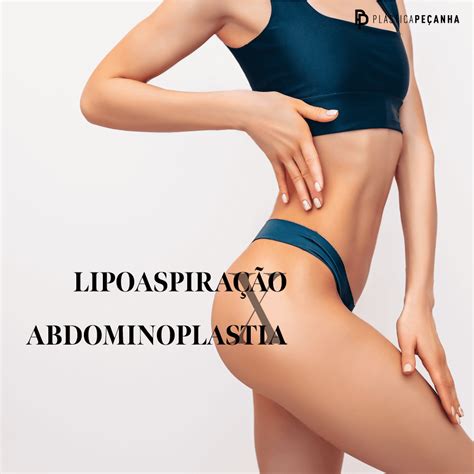 Lipoaspiração vs Abdominoplastia Guia Saúde Cidades