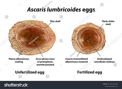 Ascaris Lumbricoides Life Cycle Pathogenesis Lab Off