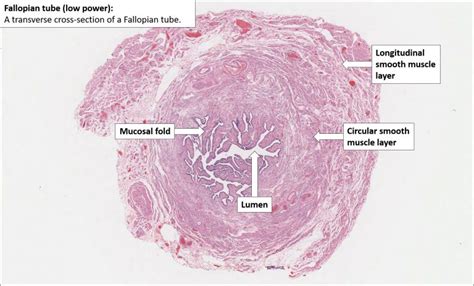 Fallopian Tube Normal Histology Nus Pathweb Nus Pathweb