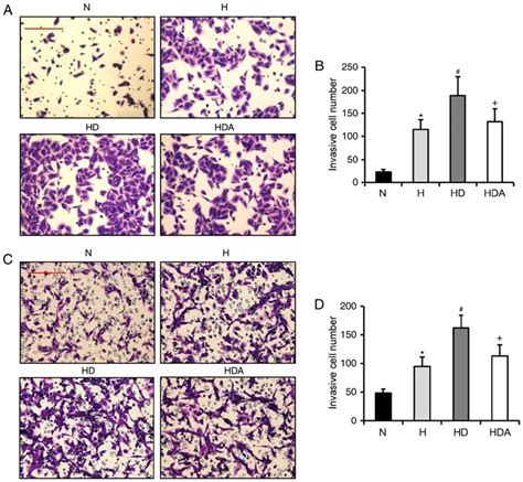 Dexmedetomidine Enhances The Hypoxia Induced Invasion Ability Of Cancer