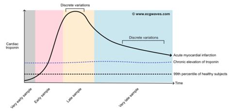 Troponine cardiaque I TnI et T TnT Interprétation et évaluation