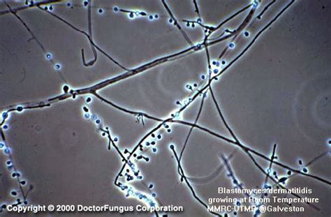 Blastomyces Species - Doctor Fungus