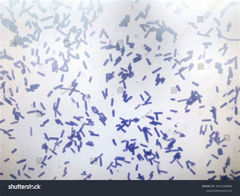 Bacillus Cereus Gram Positive Micrograph Stock Photo