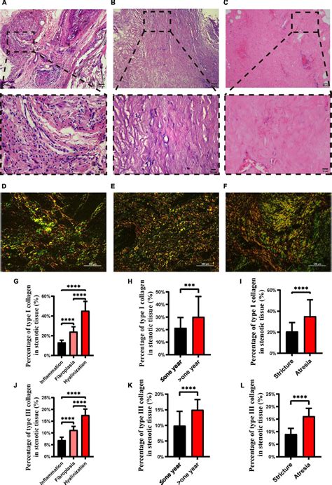 H E Staining And Picrosirius Red Staining Of Different Ureteral