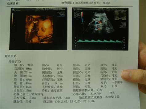 三维彩超检查项目可不少排畸妇科病筛查样样不落 家庭医生在线