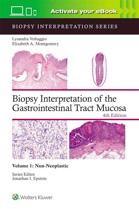 Biopsy Interpretation Of The Gastrointestinal Tract Mucosa Volume 1 Non Neoplastic Print