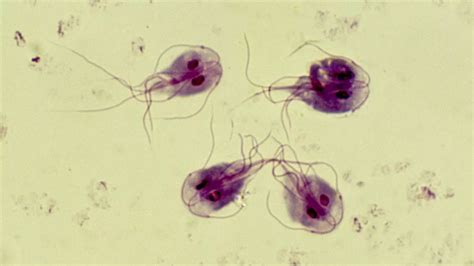 What Is Giardiasis Infection At Uk Primary School Explained And Signs To Look For Mirror Online