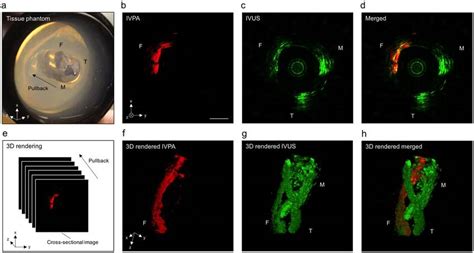 Ivpa Us Imaging Of Tissue Phantom At 16 Fps A Picture Of Tissue Download Scientific Diagram