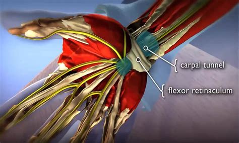 Carpal Tunnel Syndrome Symptoms And Treatment Orthoinfo Aaos