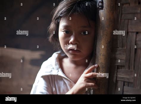 Girl Child Poor Bali Poverty Sad Challenged Extreme Hold Feed Poor