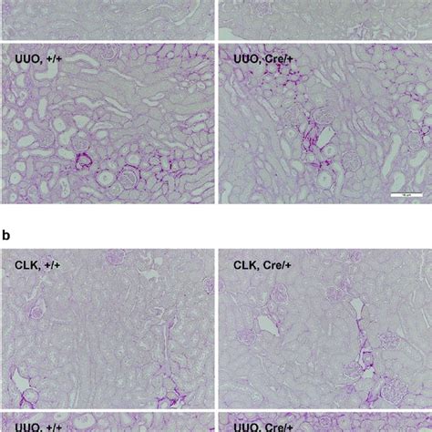 Pericyte Specific Von Hippel Lindau Protein Knockout Does Not Affect