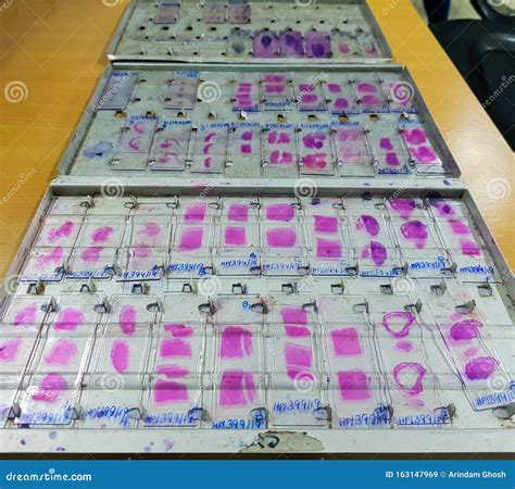 Histopathology Slides Stained with Leishman Stain, Displayed and Ready ...