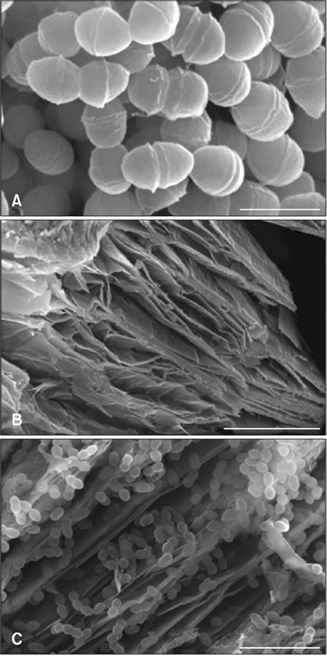 scanning electron microscope images   enterococcus  faecalis