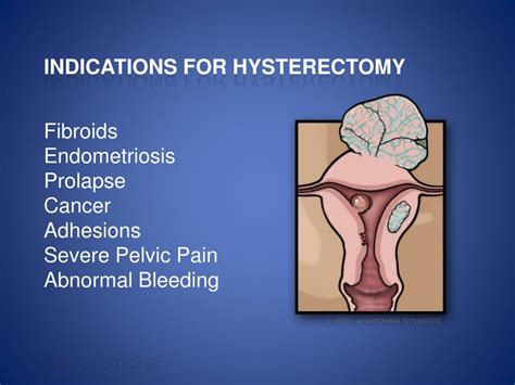 Ppt Focus Hysterectomy Powerpoint Presentation Free Download Id