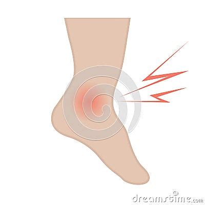 Swelling Of The Feet And Ankles From Infected Or Injury Cartoon Vector