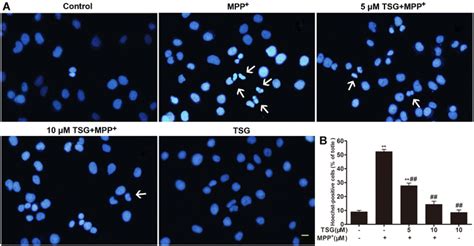 Inhibitory Effects Of TSG On MPP Induced Morphological Changes In