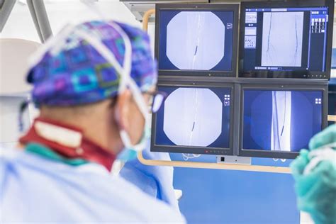Nerve Ablation Radiofrequency Ablation Purpose And Risks