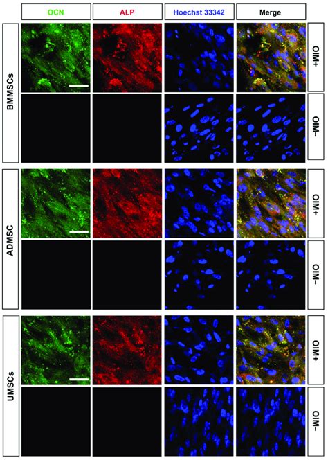 Characterization Of Osteogenesis Of HMSCs On HDCB Blocks The HMSCs Of