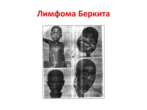 Протоонкогены и передача клеточного сигнала - презентация онлайн