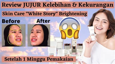 WHITE STORY Brightening REVIEW JUJUR Pemakaian Seminggu Skincare Sultan