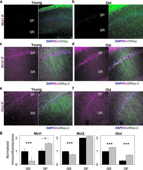 Fig Ure 5 Cellular Distribution Of Monocarboxylate Transporters Mct Download Scientific