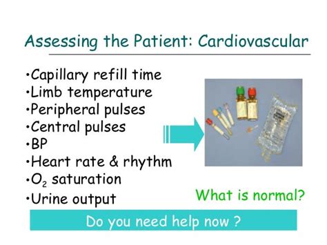 Abcde Assessment