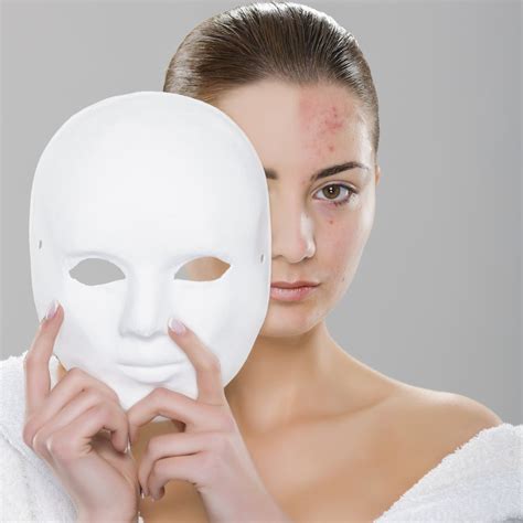 What Is Acne Fulminans? | LearnSkin