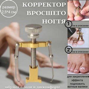 Корректор вросшего ногтя | Пластыри, корректоры, инструменты от вросших ...