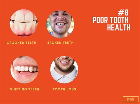 10 Common Tmj Symptoms Ppt Free Download