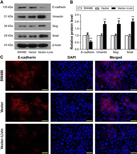 Livin Promoting The Expression Of Emt Related Markers In Sw480 Cells Download Scientific