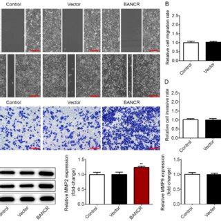 Lncrna Bancr Overexpression Promotes The Migration And Invasion Of