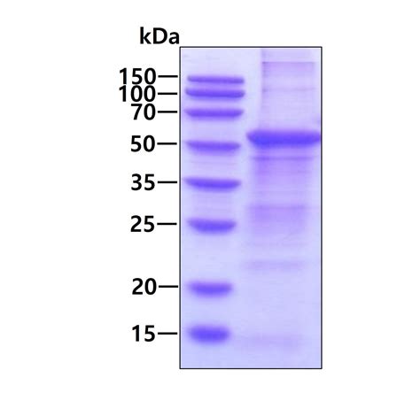 Recombinant Human Angiopoietin Protein Denatured Ab