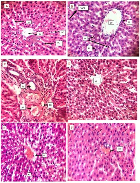 Representative Photomicrographs Of Liver Tissues Sections ×400 In Download Scientific Diagram