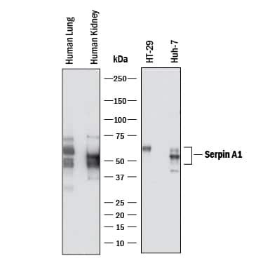 Serpin A Alpha Antitrypsin Antibody Unconjugated