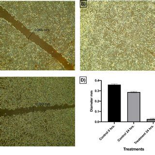 Effect Of Compound 14a On Cells Migration And Healing Efficacy Of